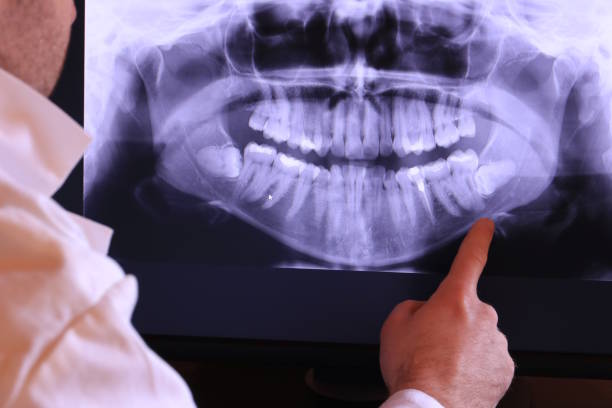 Best Emergency Dental Extractions in Lealman, FL